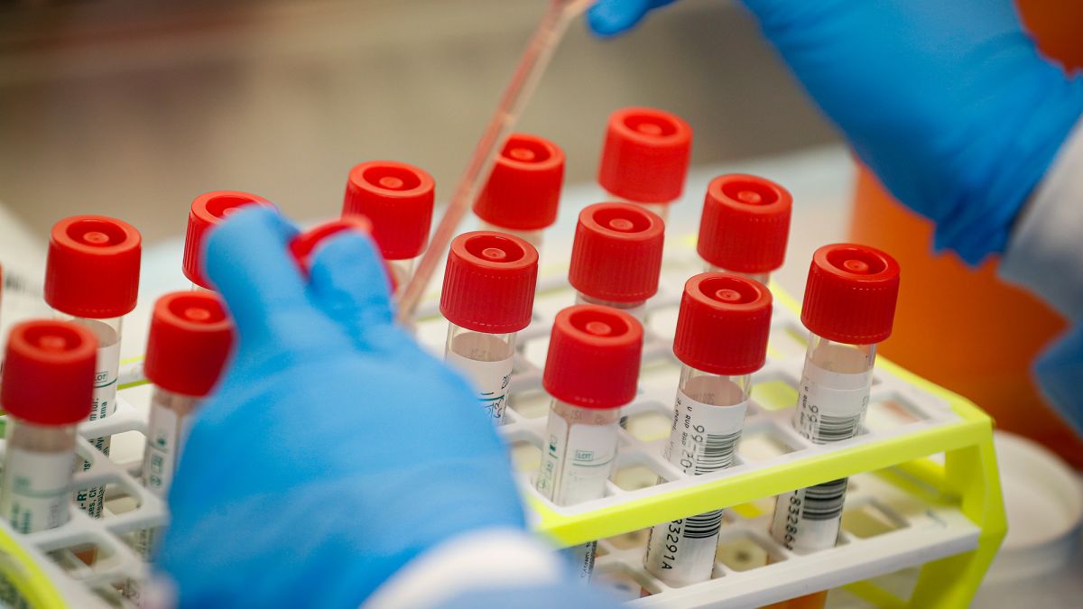 MEDICAMENTO SECRETO – Cientistas testam remédio que reduz 94% da carga viral da covid-19